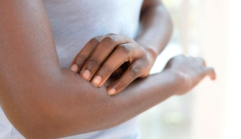 Which Lotions Are Best For Dry Itchy Skin?